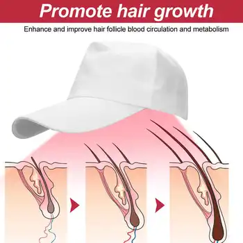 280pcs vinuté Perly Rast Vlasov Laser Prilba Terapia Anti-Hair Loss Nastaviteľné Rast Vlasov Spp Svetlo Čip starostlivosť o Vlasy Klobúk Auta